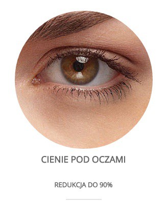 Cienie pod oczami