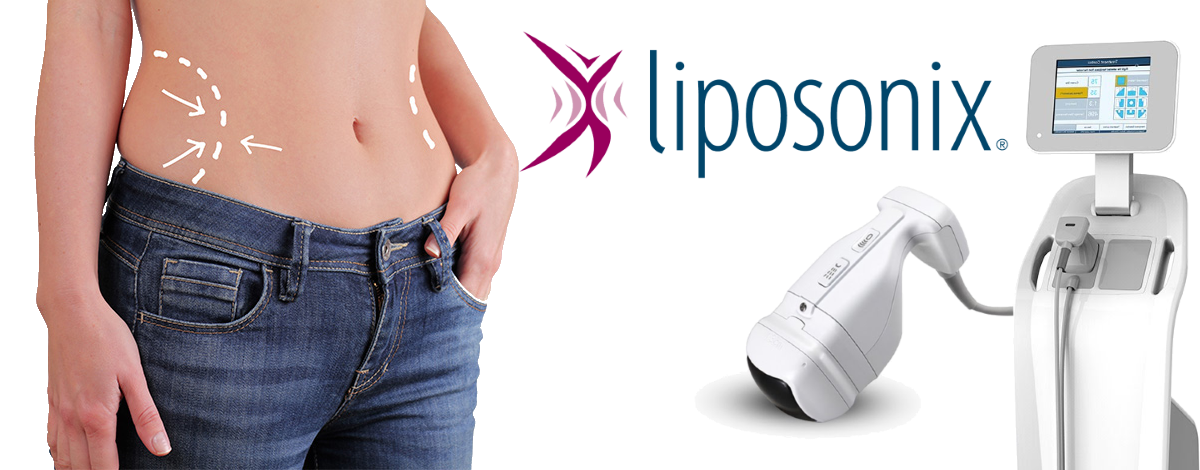 Liposonix HiFu Solta Medical