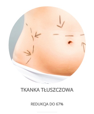 Tkanka tłuszczowa